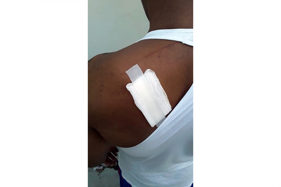       Inmate attacked with machete  in prison, another man injured   