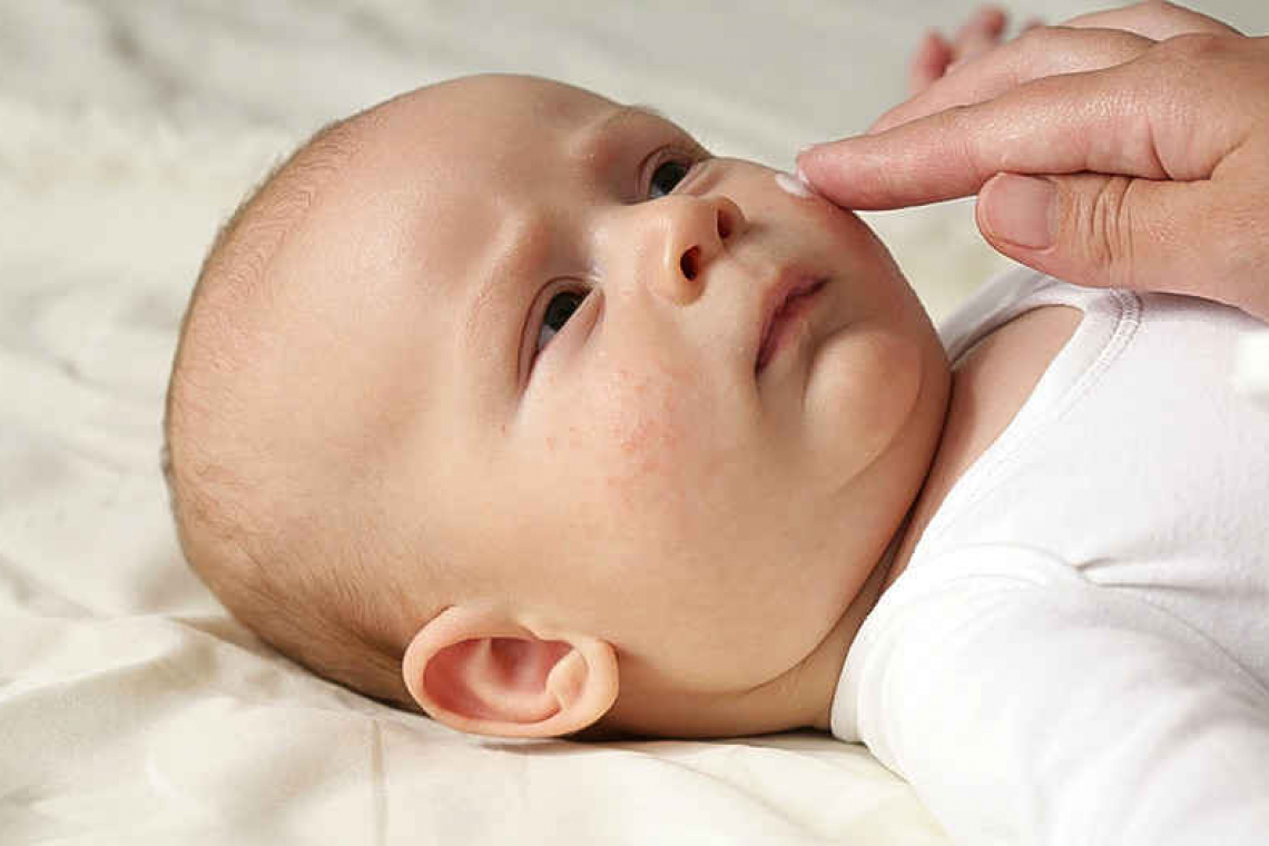 One of the worst itches: infant eczema