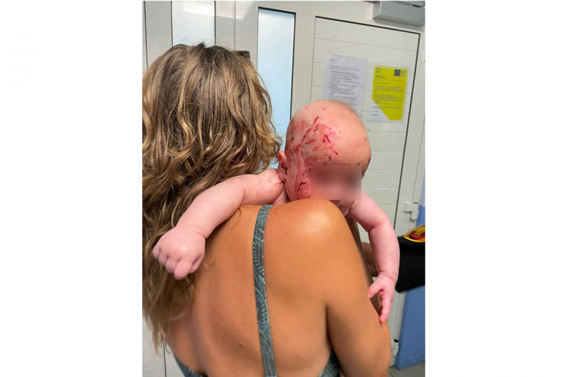 Bikers attack family in  car, baby badly injured