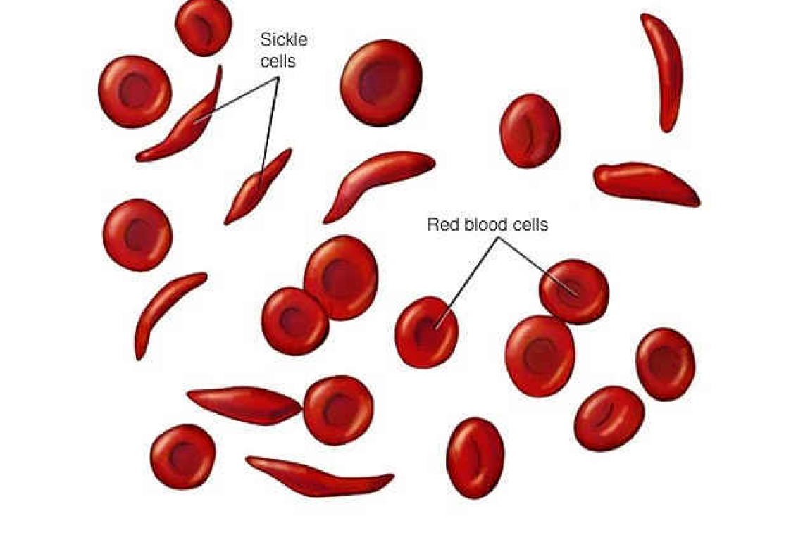Home DNA testing and sickle-cell anaemia