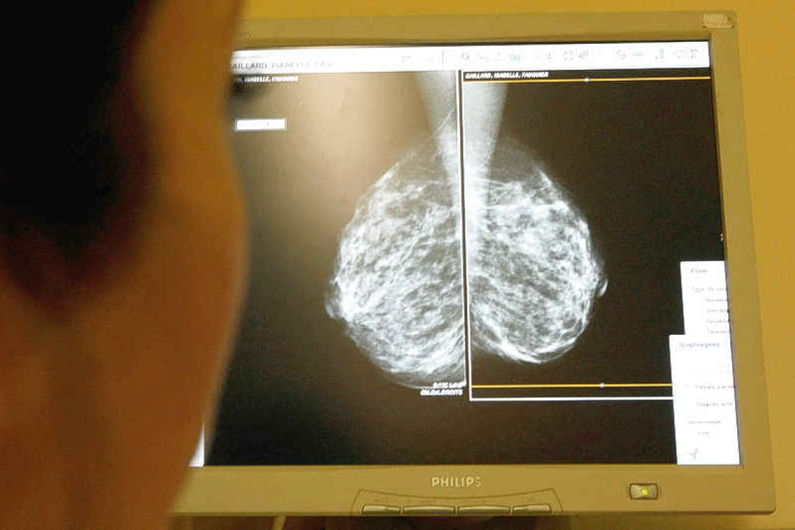 Breast cancer screening should begin at age 40
