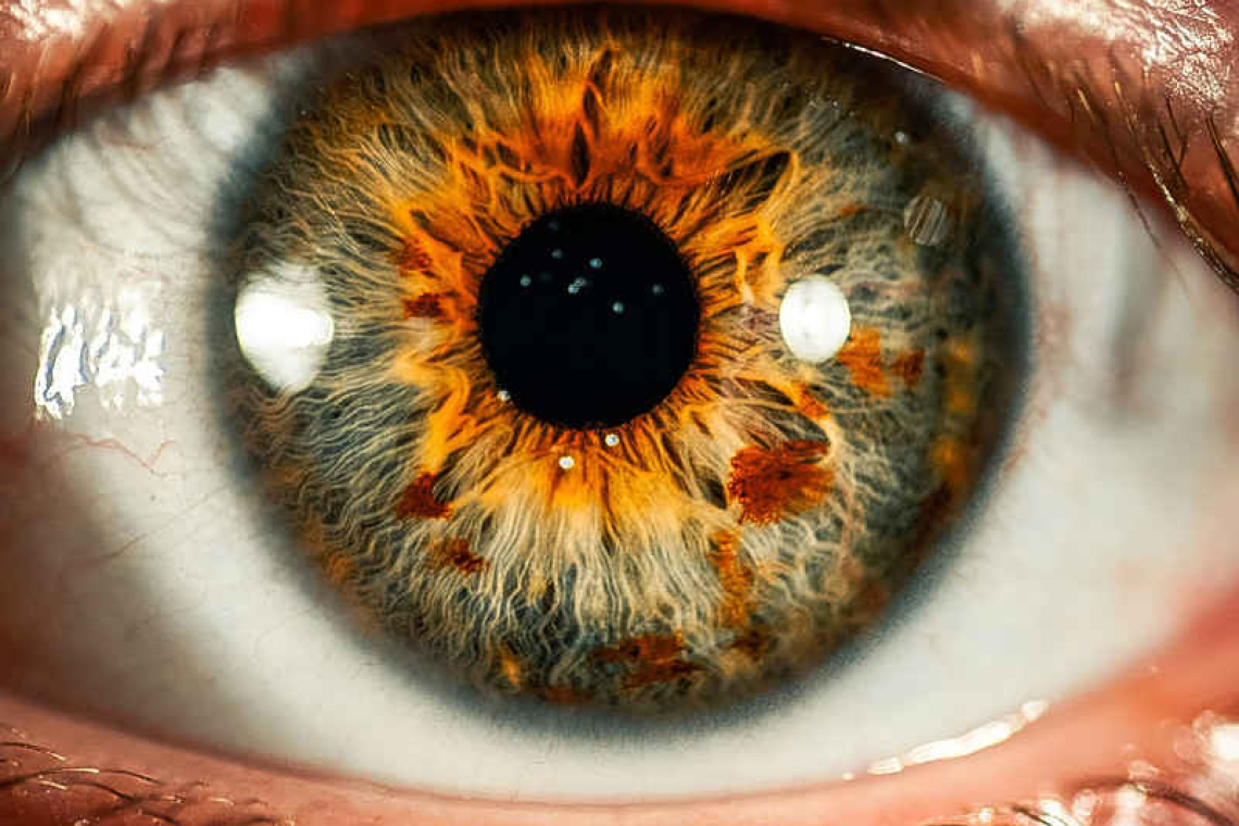 How are your eye pressures?